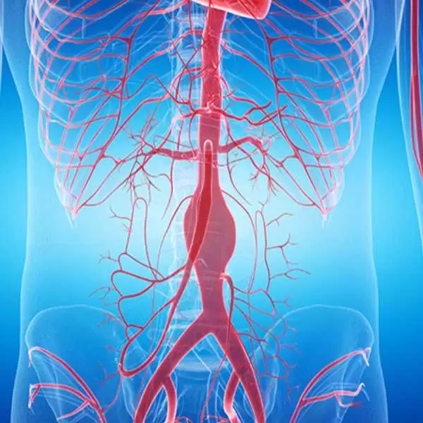 جراحة الأوعية الدموية (2)